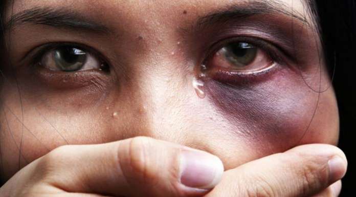 Nulta tolerancija prema nasilju nad ženama: Ne smeš da ćutiš i trpiš